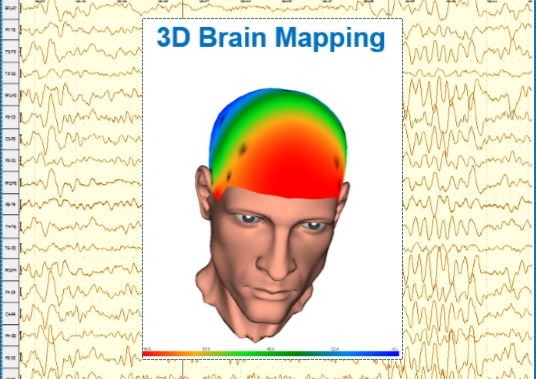 eeg2 3d brain mapping